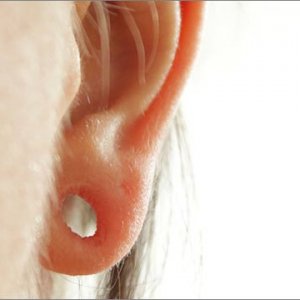 Urechi despicate  