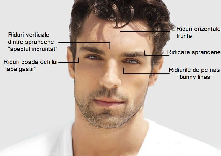 cum să eliminați ridurile orizontale de pe frunte